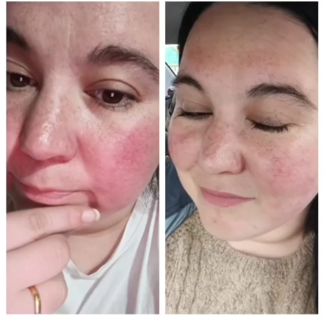 RENOVA+ | Regeneración real desde la biología