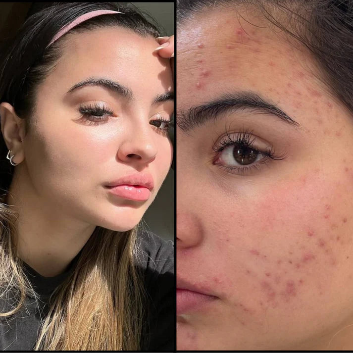 RENOVA+ | Regeneración real desde la biología